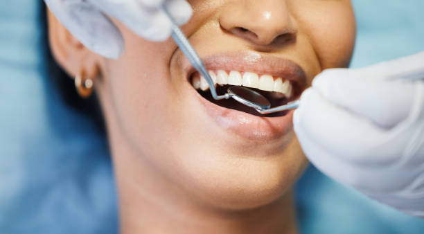 Best Emergency Broken Tooth Repair in Lake Camelot, WI