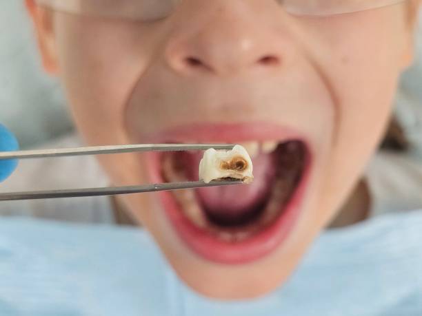 Best Emergency Dental Care for Trauma or Injury in Lake Camelot, WI
