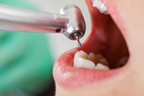 Best Emergency Treatment for Toothache in Lake Camelot, WI